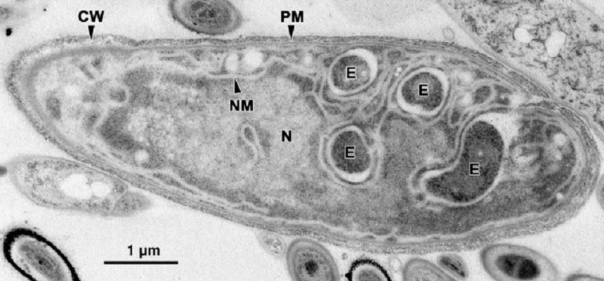 Een bijzondere eencellige, Parakaryon Myojinensis, in de eerste stappen naar eukaryotisch leven?